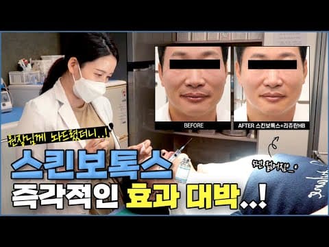 원장님에게 스킨보톡스 놔드렸더니.. 5년은 젊어지는 가성비시술 스킨보톡스의 모든 것 😎