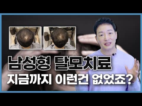 남성형 탈모치료에 효과적인 새로운 치료법 알려드립니다.