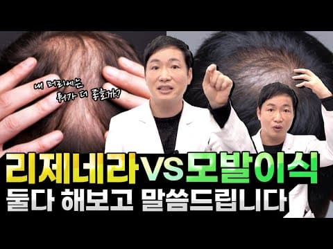 'Regenera Activa vs. Hair Transplant': Which is the better hair loss treatment? I will tell you a...