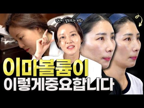 이마필러 고민중이라면 꼭! 보고 결정하세요. 이마라인이 달라지면 인상이 바뀝니다. 콜라겐주사 이마 리뷰