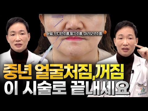 How to fix marionette lines, nasolabial folds, and mid-cheek grooves: This procedure really works...