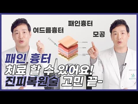 The REALLY way to get rid of pitted acne scars! It is treatable. (Sculptra, PicoFraxel, Prectora,...