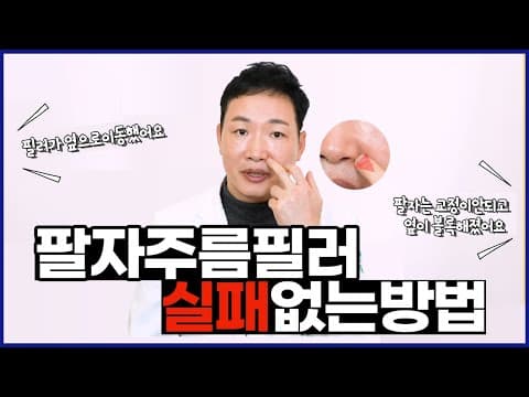 If you’ve failed at nasolabial fold filler, watch this! How to get it done right