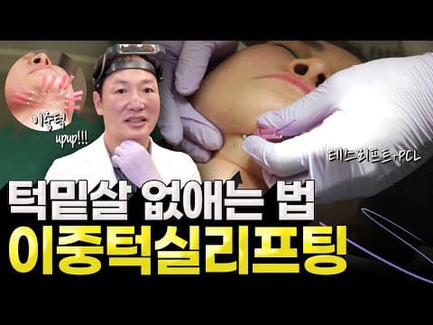 턱밑살, 이중턱 없애는 법! 실리프팅 효과보는 케이스 직접 확인하세요.