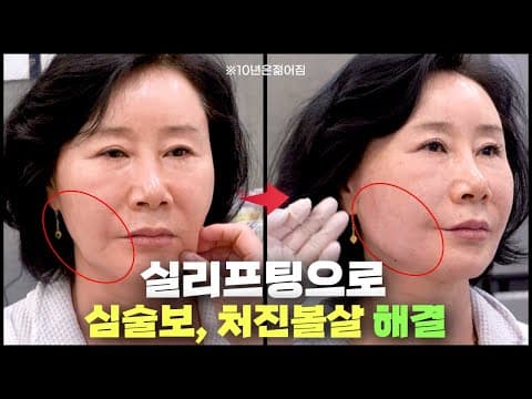 심술보, 처진볼살 실리프팅으로 없애드리면.. 이렇게 변할 수 있네요 😲