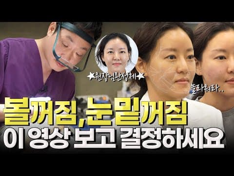 볼꺼짐, 눈밑꺼짐 채우고 더 어려진 원장님!😳 이래도.. 콜라겐주사 고민중이에요? 변화 눈으로 확인하세요!