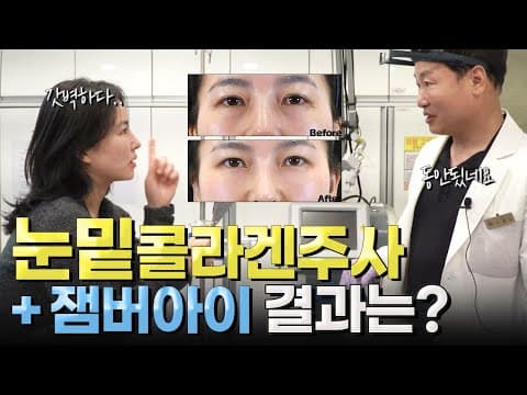 눈밑꺼짐 눈밑처짐 다크서클 3종세트 ✨완벽 해결법✨ (콜라겐터치+잼버아이)