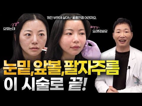 How to Fix Smile Lines and Under-Eye Hollows! Collagen Injections for Volume and Lifting Effects