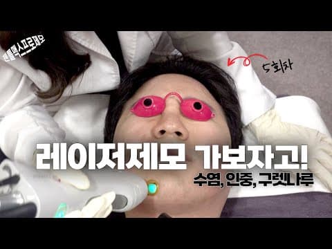 레이저제모 5회차, 남자 수염제모 가보자고 ⚡ 아파도 강력추천!!! (궁금증 해결은 덤)