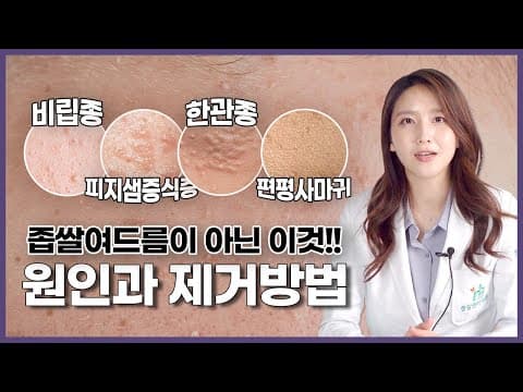 비립종 한관종 피지샘증식증 편평사마귀! 좁쌀여드름이아니라고? 원인부터 확실한 치료방법까지❗