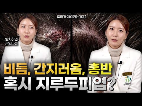 두피 가려움, 비듬의 이유..!😲 지루성두피염 발생원인부터, 관리방법 알려드립니다.