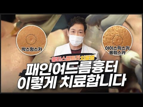 패인 여드름 흉터치료 어떻게 할까? 3step : 에어다이섹션,흉터스컬트라,프랙토라