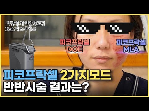아셨나요? 피코프락셀 2가지모드(MLA & DOE) 이렇게 차이가 나네요_모공,흉터,색소 치료합시다.