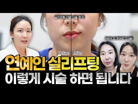 Lee Ji-hye's Thread Lift: What Are the Real Results? An Authentic Procedure Review