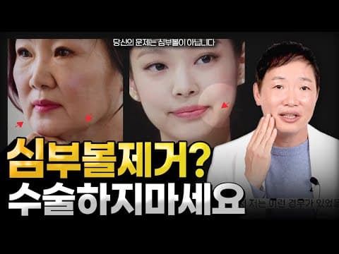 Deep cheek fat, jowls, buccinator? Make sure to check this out before surgery or thread lifting. ...