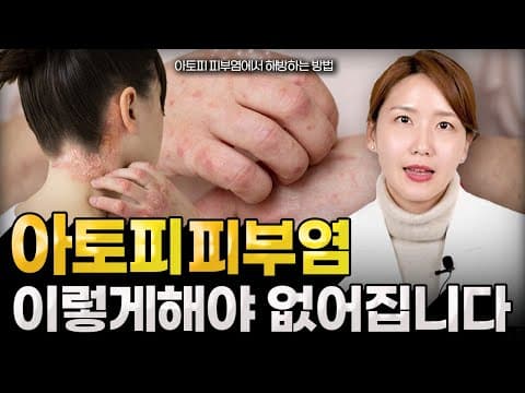 아토피 색소침착 생기기 전에 아토피 없애는 법, 예방부터 치료까지