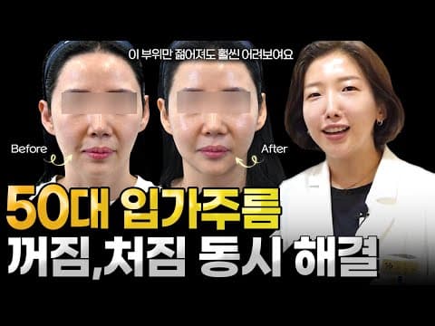 입가주름, 입가처짐, 마리오넷주름 없애는 법. 진짜 좋아집니다. 50대이상 필수시청!
