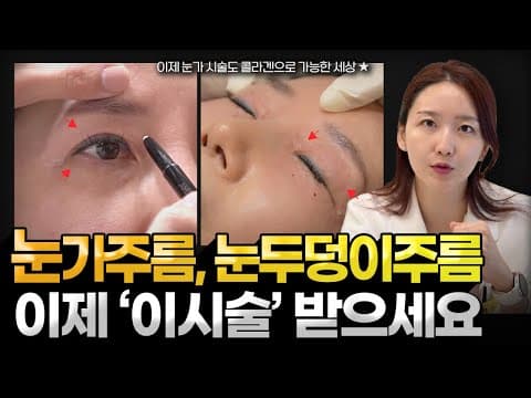 눈가주름, 눈두덩이주름 없애는 최고의 시술✨ 이제 콜라겐주사 레티젠으로 가능합니다.