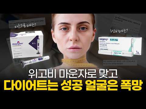 Wigobi, I lost weight after getting hit by Maunzaro, but my face looks older! The causes and solu...