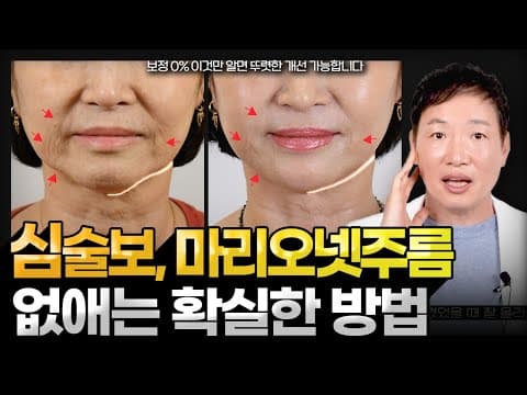 Mouth drooping, a sure way to get rid of marionette wrinkles, Must watch if you're over 50~60