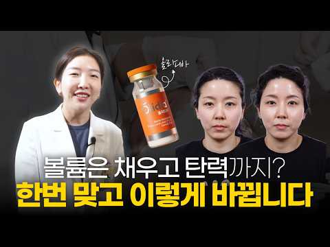 I came to add volume to my face, but you're saying lifting is possible too? From start to finish,...