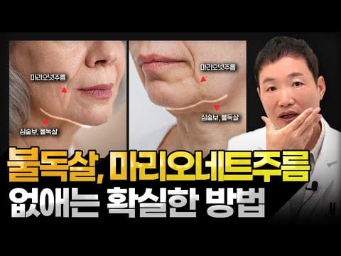 The Definitive Guide to Removing Marionette Lines, Jowls, and Bulldog Cheeks: Why Treatment Depen...
