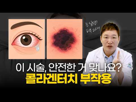 콜라겐터치 부작용 팩트체크|정말 위험한 시술일까? 의사가 직접 알려드립니다