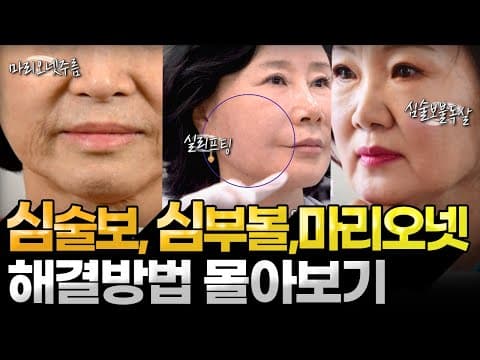 심술보, 심부볼, 마리오넷주름 해결방법 모음 zip
