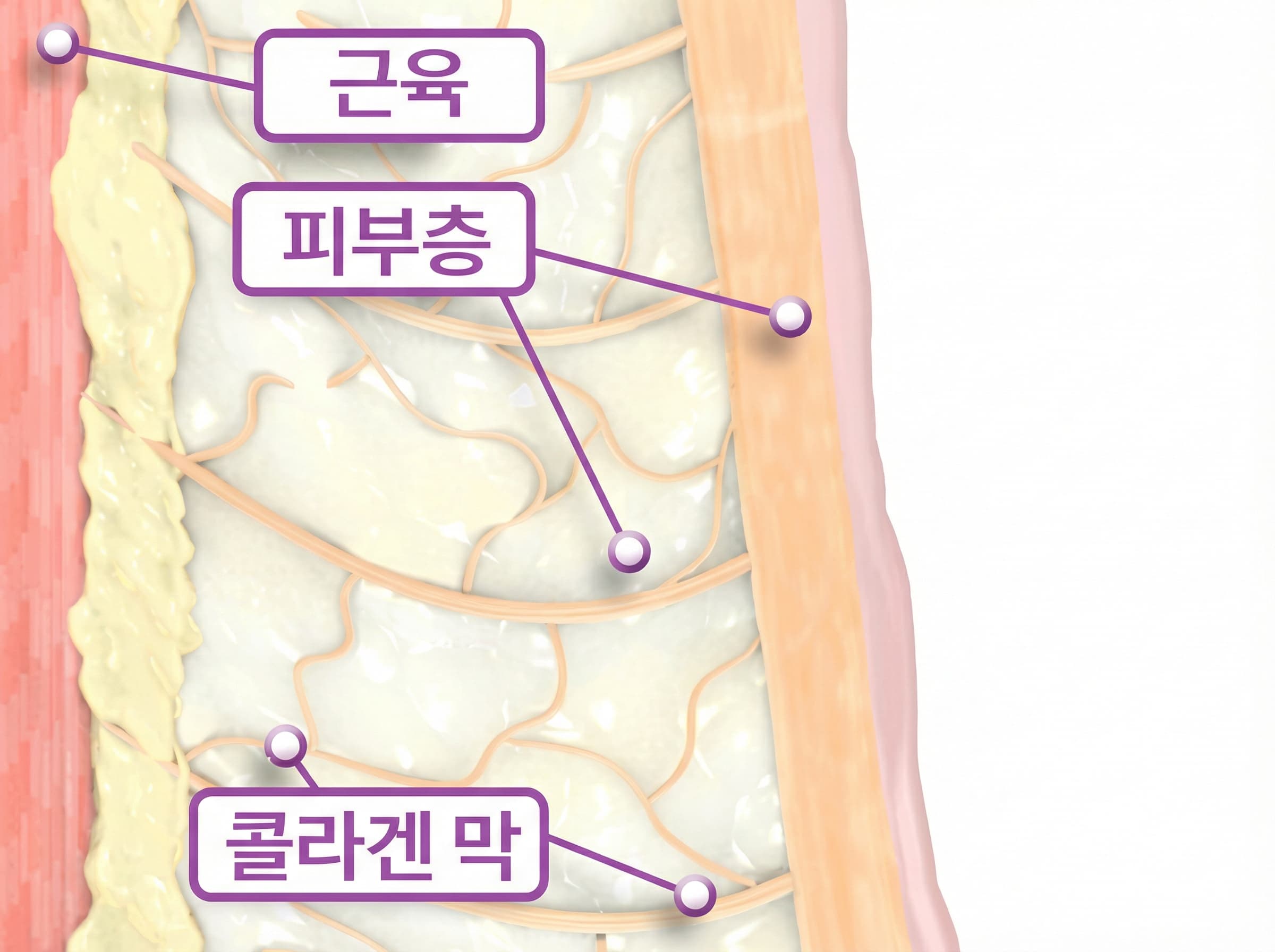RF Tightening Technology