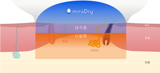 쿨링 시스템