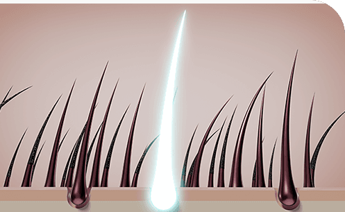 리제네라 줄기세포