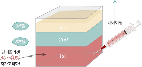 We Must Focus on Deep Fat